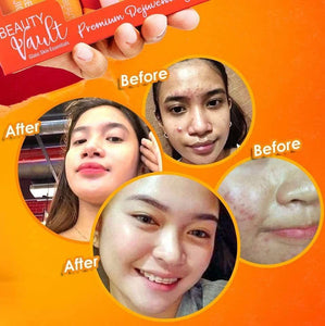 Beauty Vault Rejuvinating Set